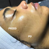 Dermaplaning odpowiedni dla wrazliwej skory