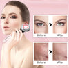 GlowLift Facial Massager