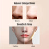 DermaGlow 5 Ultrasonic Peeling Device