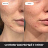 Anti-Blemish Patches
