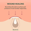 Anti-Blemish Patches