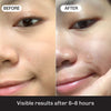Anti-Blemish Patches