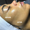SILKYFLASH+ Ultrasonic Epilator