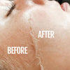 SILKYFLASH+ Ultrasonic Epilator