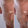 SILKYFLASH+ Ultrasonic Epilator