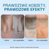 Widocznie bardziej napieta skora juz po 14 dniach