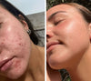 LED Facial Mask