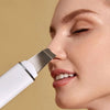 DermaGlow 5 Ultrasonic Peeling Device