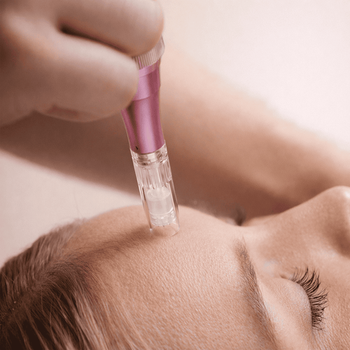 Microneedling Pen Derma Expert
