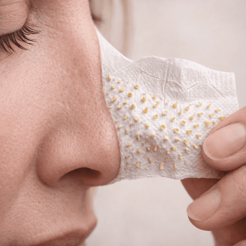 Mitesser Entferner Creme