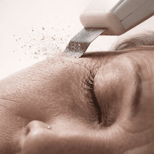 Ultraschall Peeling Gerät DermaGlow 5