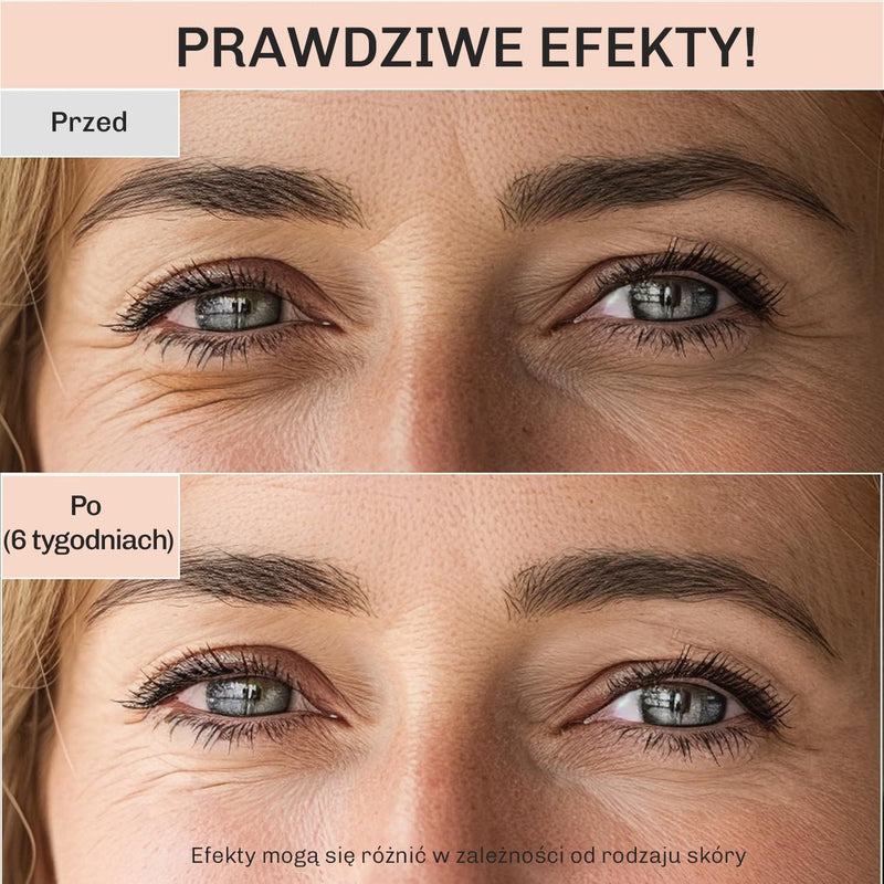 Krem rozjasniajacy cienie i zmniejszajacy opuchlizne