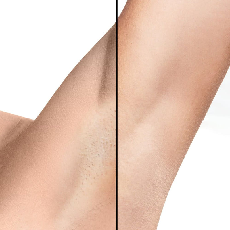 IPL Haarentferner Lumi