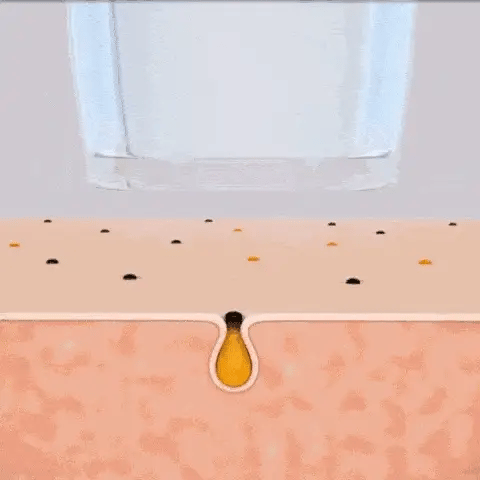 Oczyszczacz por usuwajacy zanieczyszczenia i sebum
