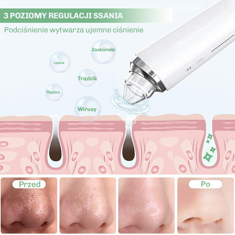 Odkurzacz do por z regulacja mocy dla kazdego typu skory
