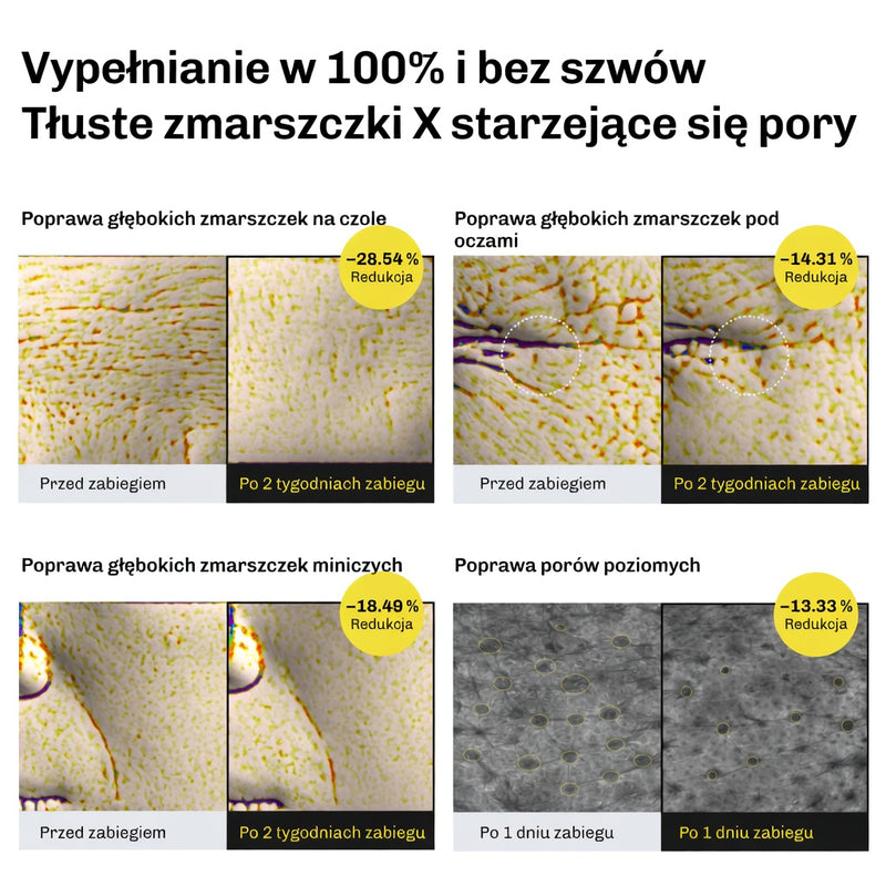 Serum poprawiajace wyglad porow i redukujace zmarszczki