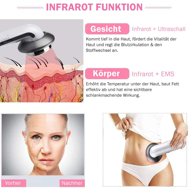 Vorher-Nachher Vergleich mit dem Silky Planet Anti-Cellulite Gerät Kylea – sichtbare Straffung und Verbesserung der Hauttextur nach regelmäßiger Anwendung.