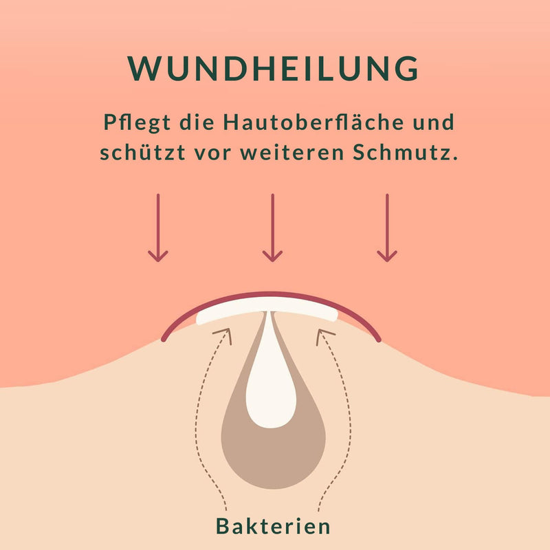 Größenvergleich der Silky Planet Anti-Pickel Pflaster in 10 mm und 12 mm – passend für unterschiedliche Pickel-Durchmesser und Hautstellen.