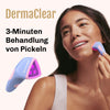 Detailansicht des Silky Planet DermaClear Akne-Lichttherapiegeräts mit ergonomischem Design und LED-Innovationen.