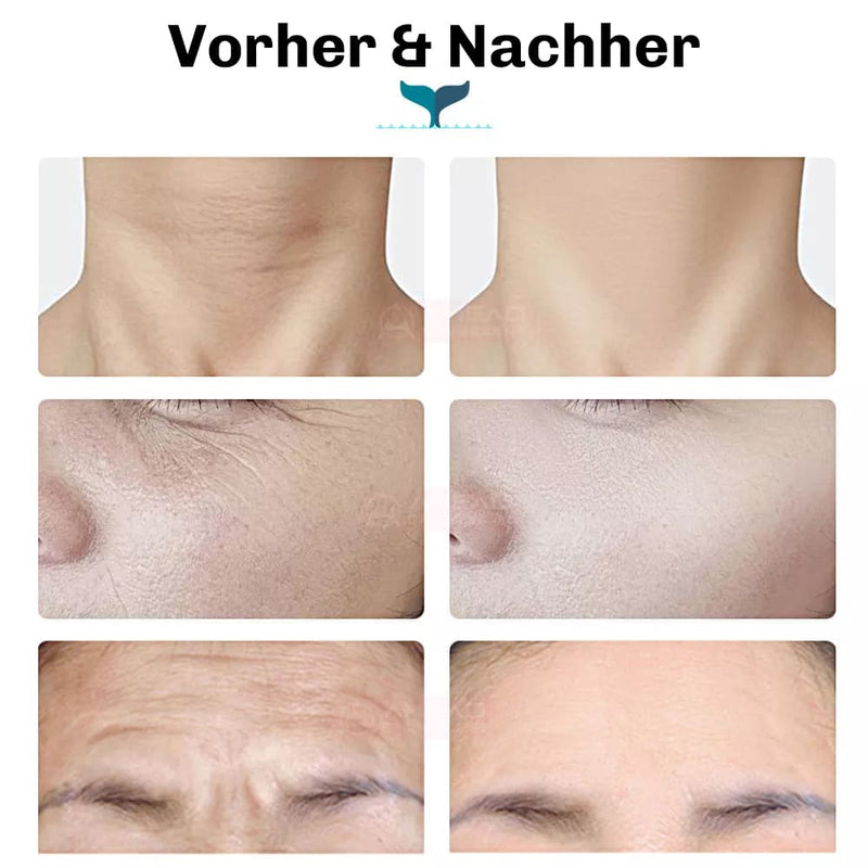 Silky Planet EMS Facelifting Gerät Jane – auch für Hals und Dekolleté geeignet, zur Straffung dieser sensiblen Zonen und zur Konturenverbesserung.