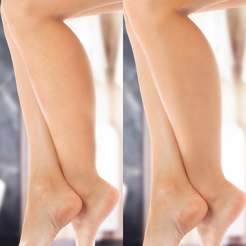 Geschenkidee: Silky Planet IPL Haarentferner Glamour Expert – perfektes Beauty-Tool für langanhaltend glatte Haut als Präsent.