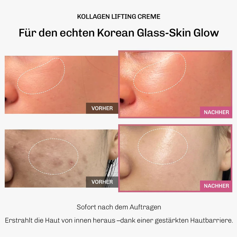 Speziell geeignet: Silky Planet Kollagen Lifting Creme für reife Haut und alle Hauttypen – stärkt die Kontur, vermindert Elastizitätsverlust und verleiht Glow.