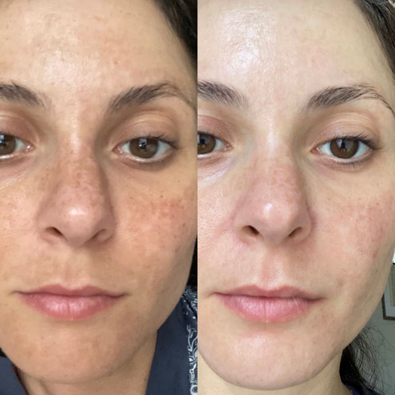 Geschenkidee: Silky Planet Kollagen Lifting Creme – luxuriöse Pflege für sichtbare Straffung und einen jugendlichen Teint.