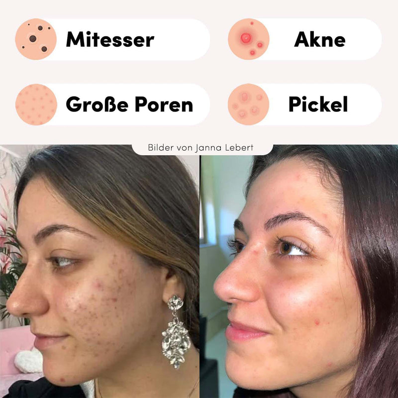 Pflege-Tipp: Silky Planet Mitesser Home Creme abends auf gereinigte Haut auftragen, um Mitesserbildung entgegenzuwirken und Poren zu verfeinern.