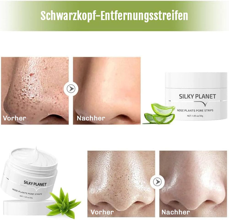 Vorher-Nachher Vergleich mit der Silky Planet Mitesser Home Creme – sichtbar klareres Hautbild und reduzierte Mitesser.