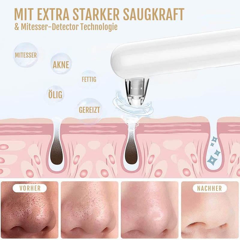 Verpackung und Lieferumfang des Silky Planet Mitesser & Porenreinigers – Hauptgerät, Aufsätze, Ladekabel und Anleitung.