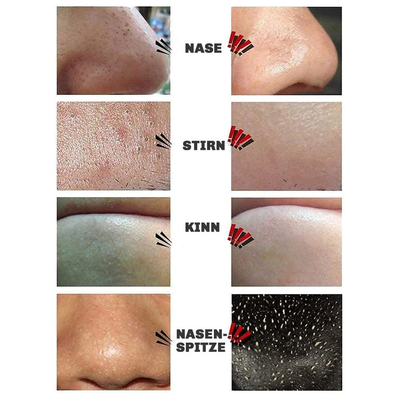 Vorher-Nachher Vergleich: Haut vor und nach der Anwendung der Silky Planet Mitesserentferner Maske – sichtbar verfeinerte Poren und reiner Teint.