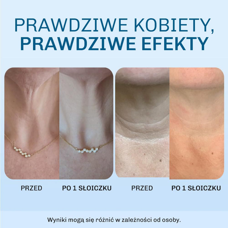 Widocznie bardziej napieta skora juz po 14 dniach