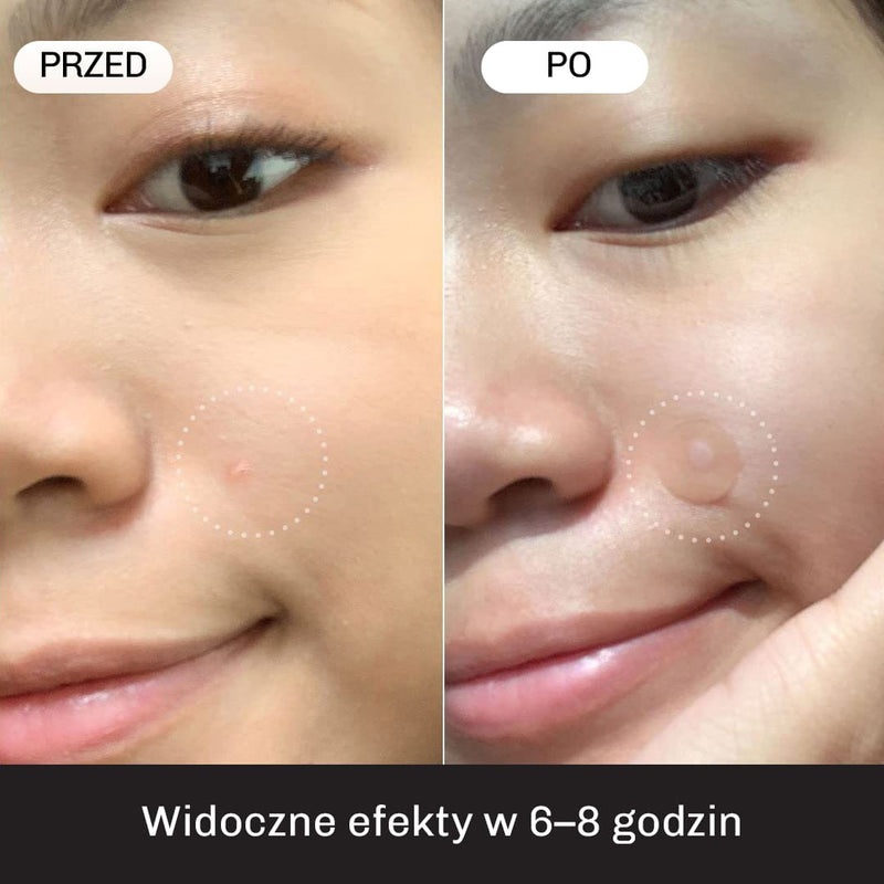 Hipoalergiczne plastry bezpieczne dla kazdej skory