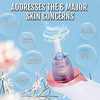 SkinClear 3 Blackhead Remover