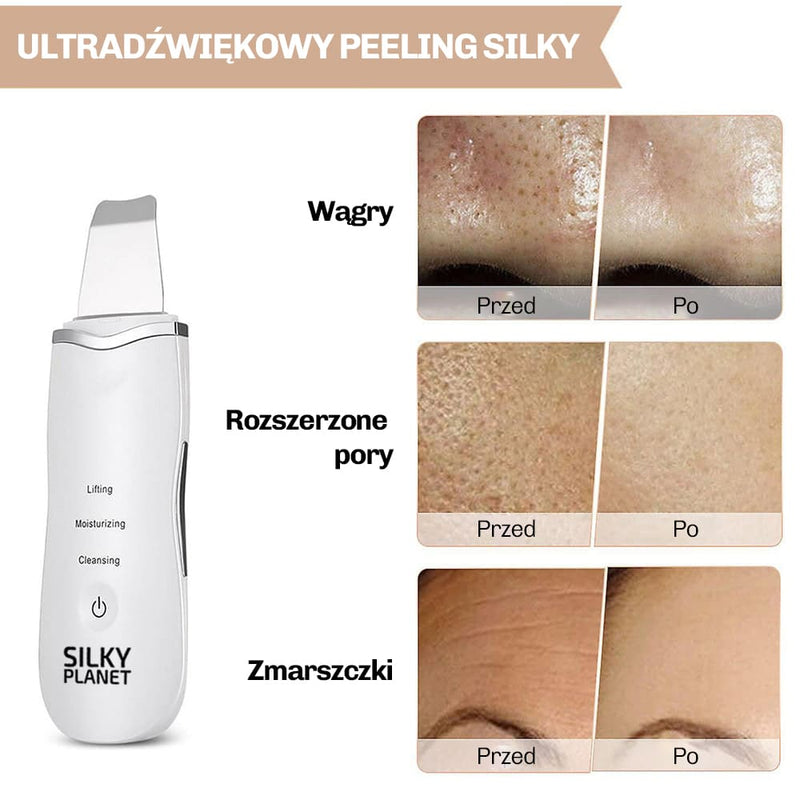 Zabieg ultradzwiekowy poprawiajacy krazenie i dodajacy blasku