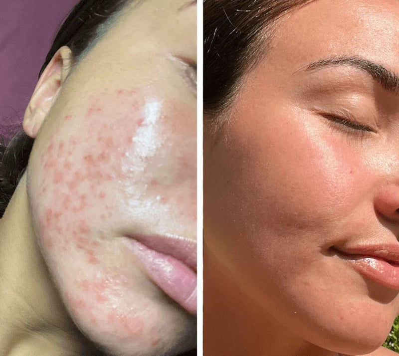 Technologie der Silky Planet LED Lichttherapie Gesichtsmaske – gezieltes Rot- und Infrarotlicht zur Stimulation der Kollagenbildung und Hautregeneration.