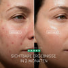 Gesichtsmaske mit Lichttherapie fuer glatte gepflegte und frische Haut