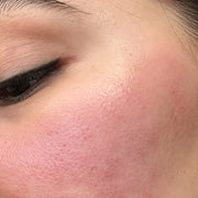 Glow before
