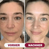 Vorher–Nachher: sichtbar verfeinerte Poren, ebenmäßiger Teint und reduzierte Glanzzonen