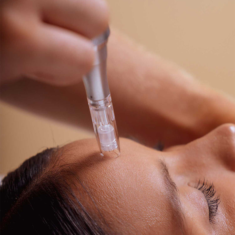 Einstellbare Nadeltiefe beim Derma Pen – präzise Anpassung je nach Hautzone und Bedarf