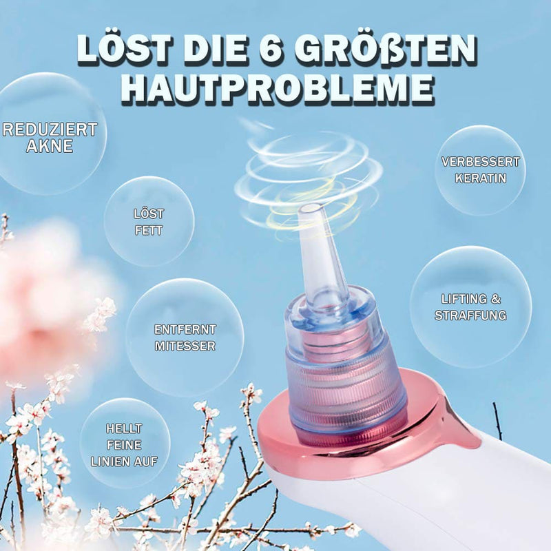 Mehrere Saugstufen für unterschiedliche Hauttypen – sanft bei sensibler Haut, stärker gegen hartnäckige Mitesser