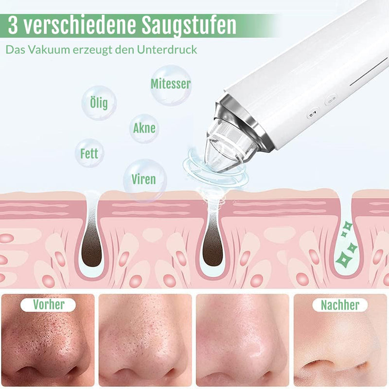 Porenreiniger mit sanfter Vakuumtechnologie gegen Mitesser und Talg