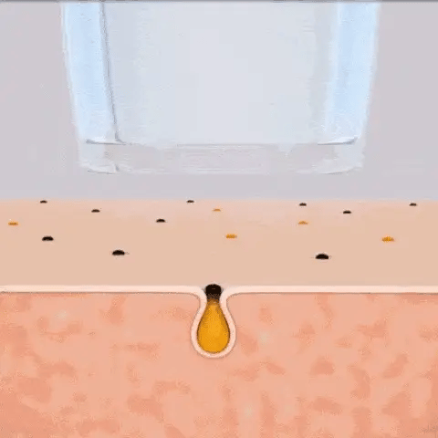 Porensauger mit integrierter Kamera und Live Ansicht auf dem Smartphone