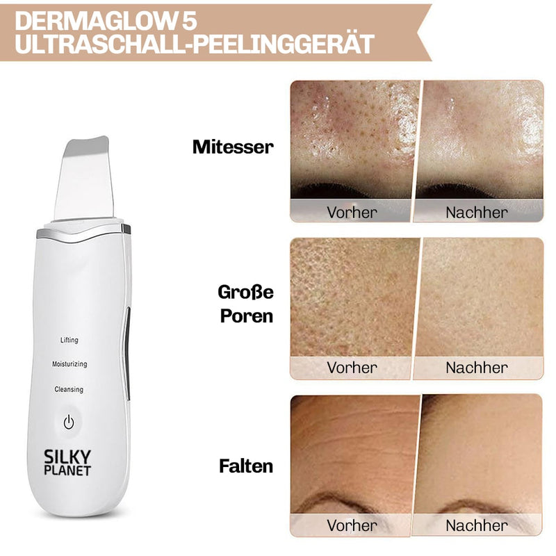 Vorher-Nachher: verfeinerte Poren, glattere Struktur und sichtbar klareres Hautbild