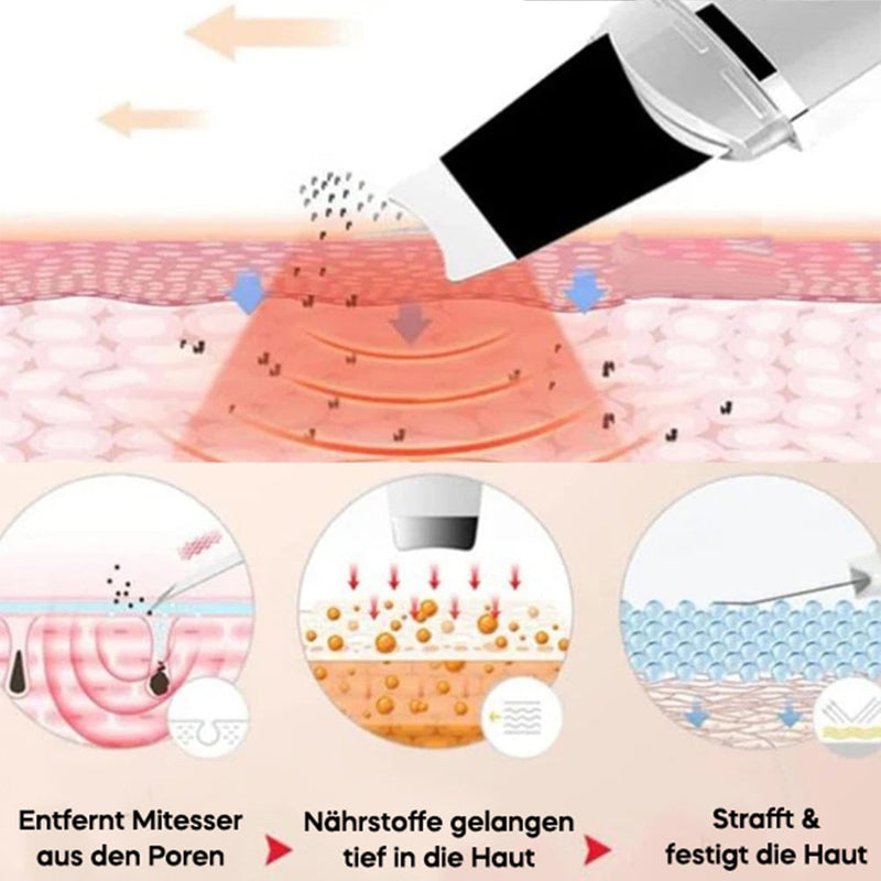 Hygienische Reinigung: Spatel nach der Behandlung mit Wasser abspülen und trocknen